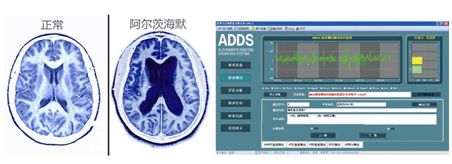 ADDS-100认知功能障碍筛查系统(图2)
